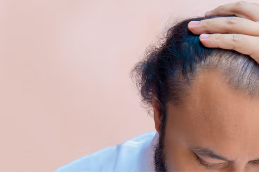 Hair Loss Treatment Options: What Works for Real Routines