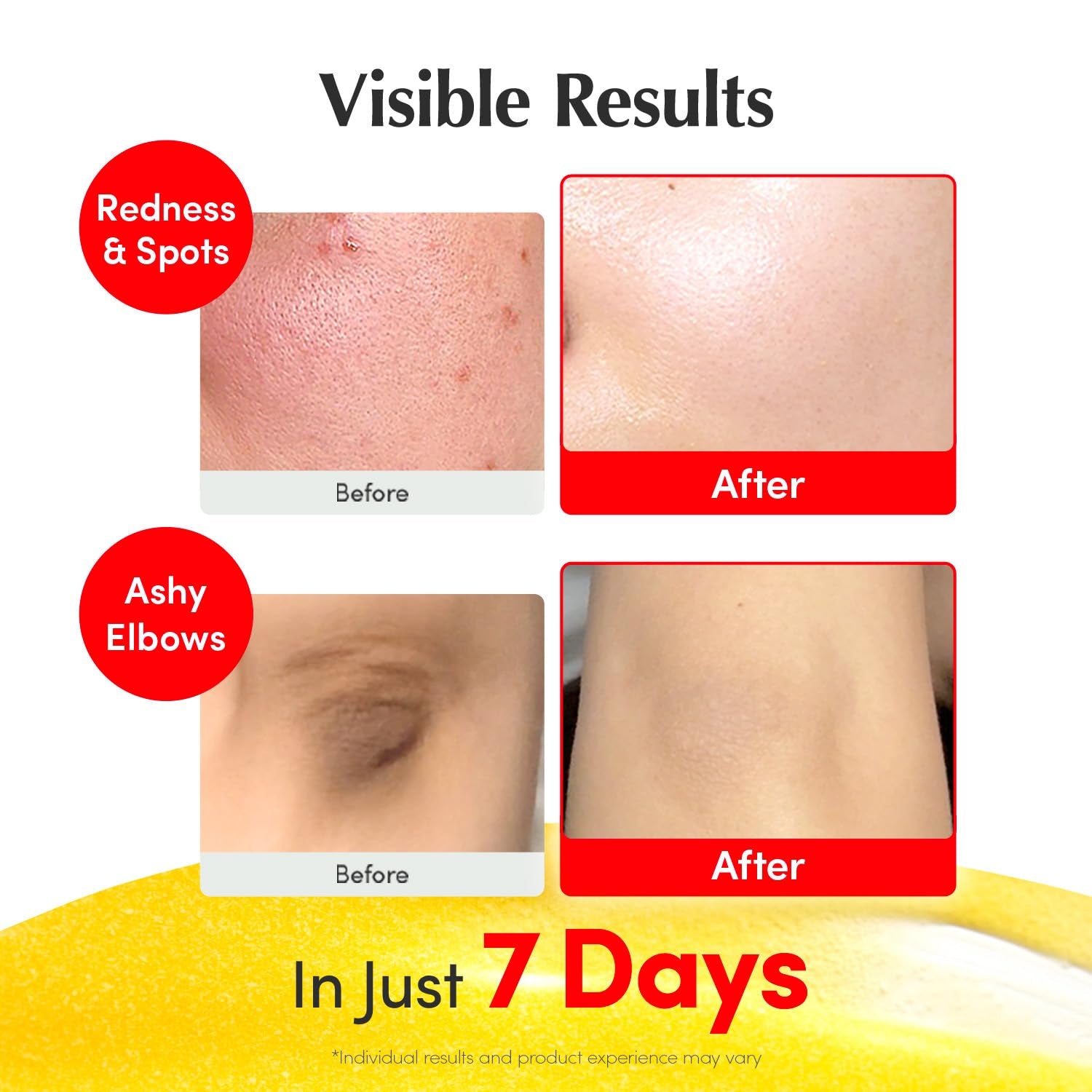 EQQUALBERRY Vitamin Illuminating Serum | Niacinamide 4% + Brightening Vitamin C Face Serum
