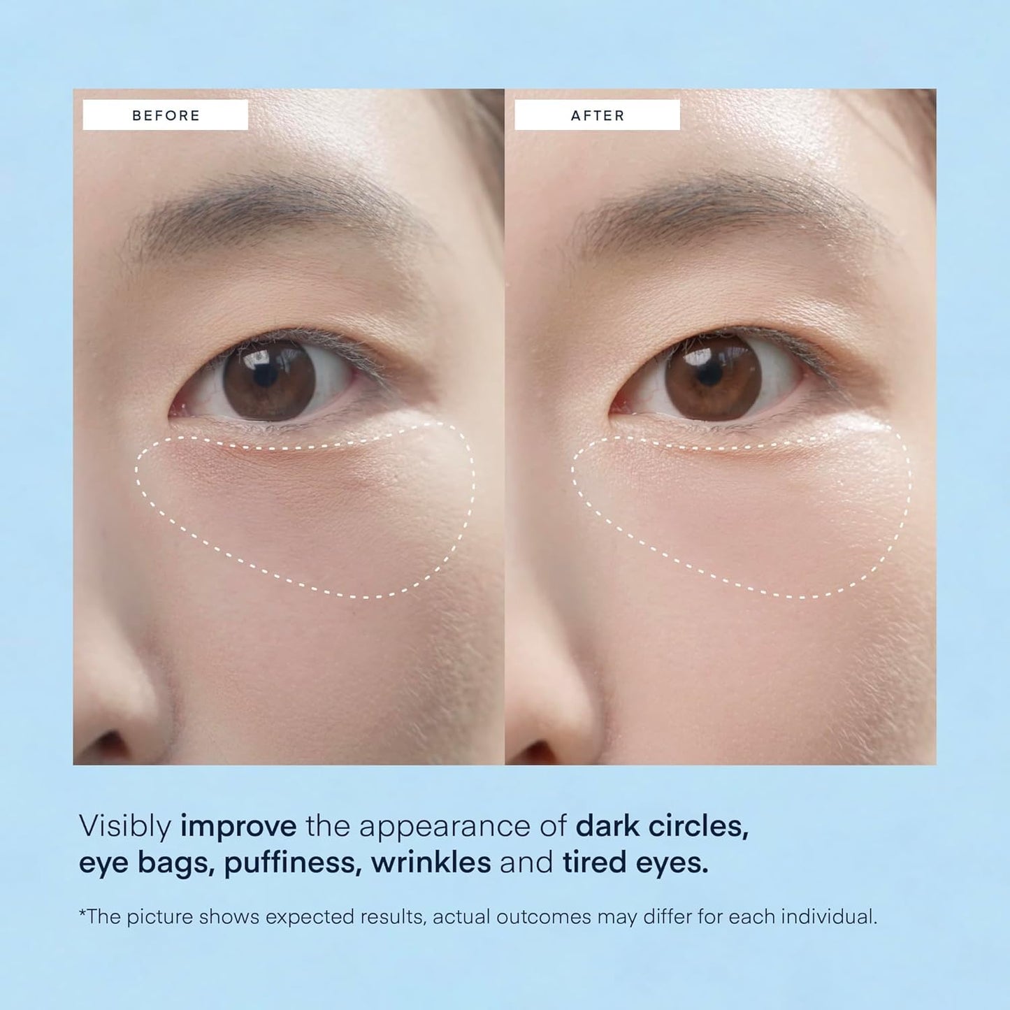 Terez & Honor Under Eye Patches for Dark Circles - 60 Korean Hydrogel