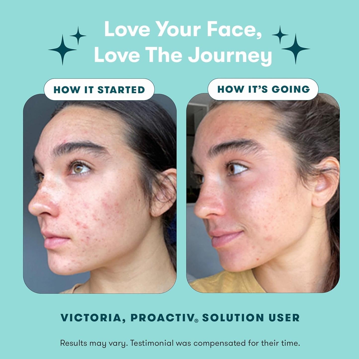 Proactiv 3 Step Acne Treatment