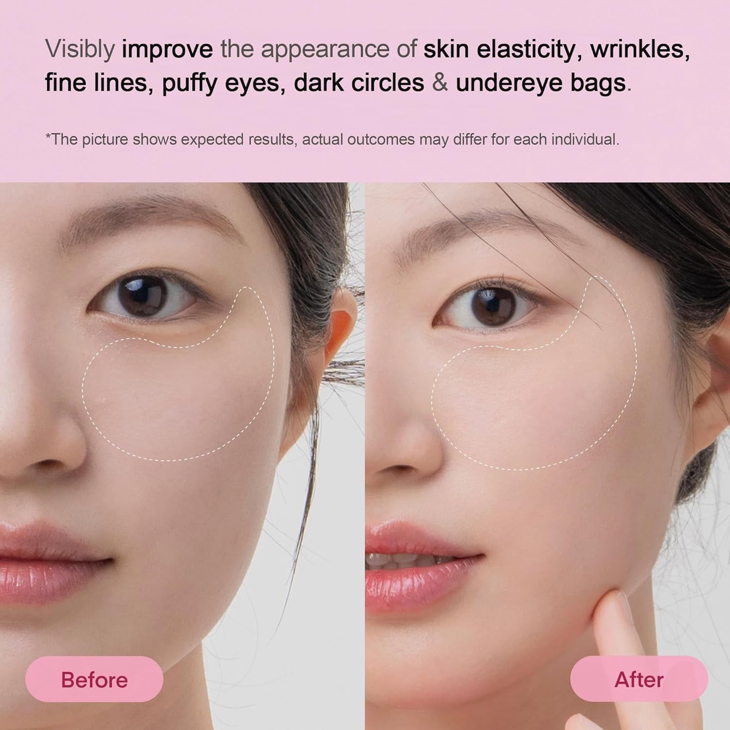 TEREZ & HONOR Peptide Collagen Under Eye Patches - 60 Korean Firming