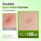 Anua Azelaic Acid 10 Hyaluron Redness Soothing Serum