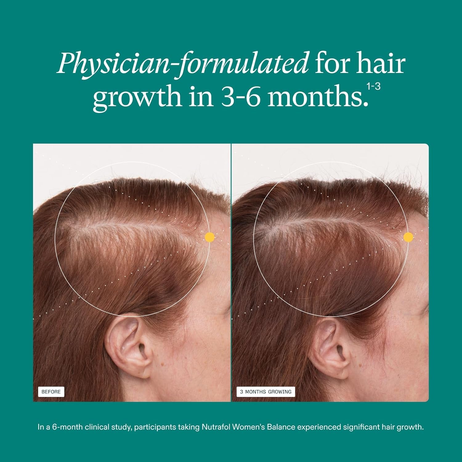 Nutrafol Women's Balance Hair Growth Supplements