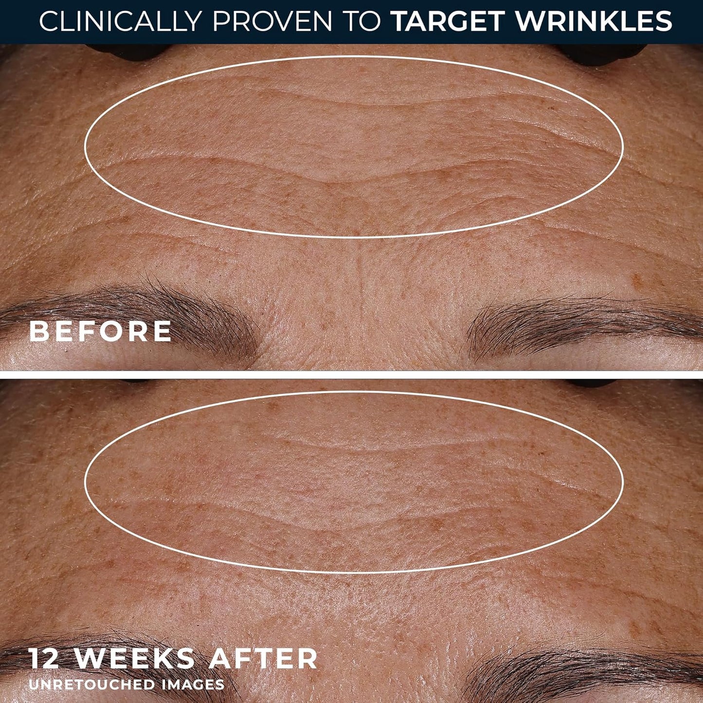 RoC Retinol Correxion Night Cream for Deep Wrinkles