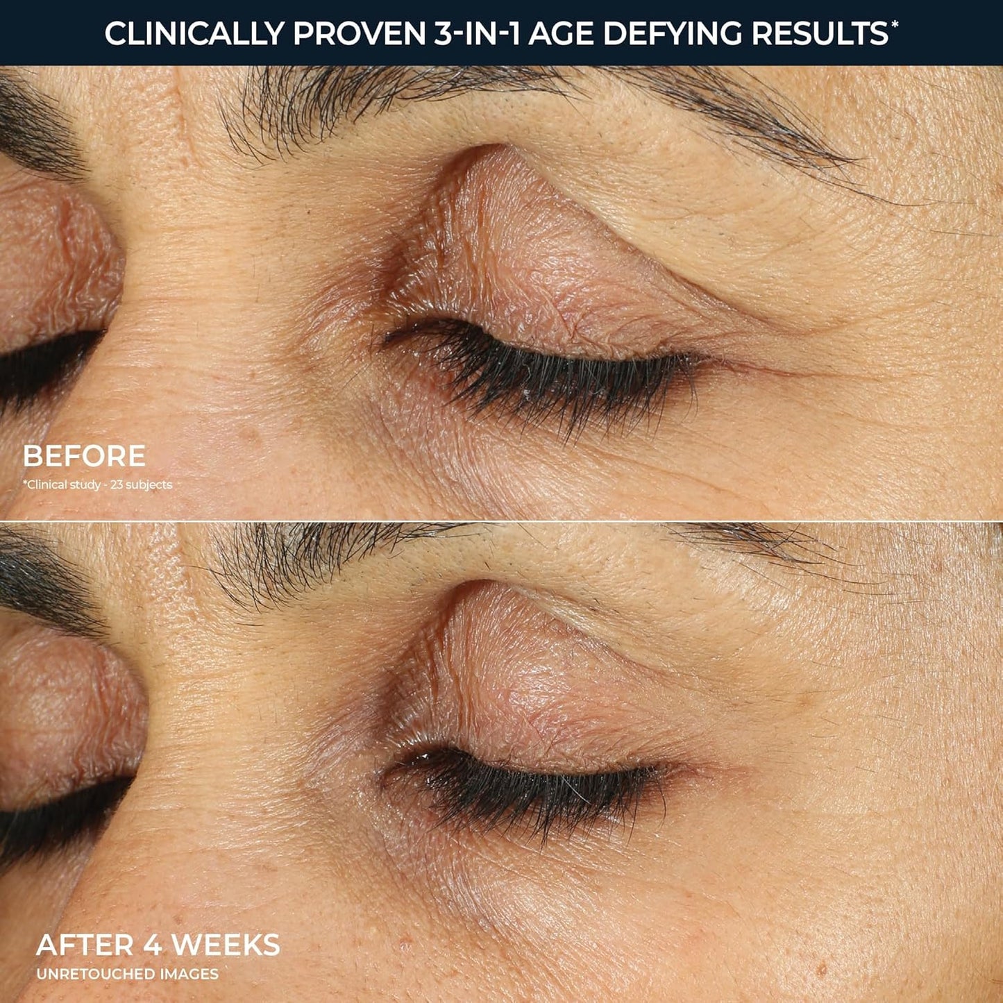 Roc Retinol Correxion under Eye Cream for Dark Circles & Puffiness