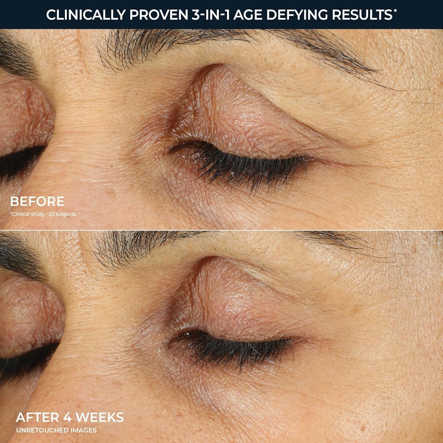 Roc Retinol Correxion under Eye Cream for Dark Circles & Puffiness
